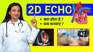 2D Echo Test for Heart  Kaise Hota Hai Kyu Kiya Jata Hai Echocardiography Test Procedure [upl. by Gonzales]