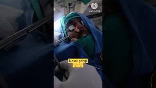 nasal polypent noseshortsshortvideo ytshorts remove [upl. by Richer]