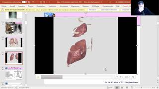 10 Scissure et segments visualisation en 3D [upl. by Pacheco]