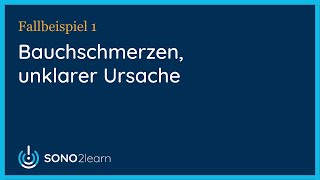 Bauchschmerzen unklarer Ursache  Ultraschall  Fallbeispiel 1 [upl. by Akeihsal]