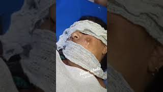 Botfly Maggot Removal spa doctor satisfying pimple removal [upl. by Nnyllaf]