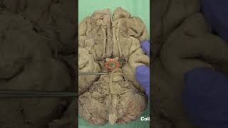 Ventral aspect of hypothalamus anatomy neuroanatomyhypothalamusbrainbrainanatomy [upl. by Suoiradal]