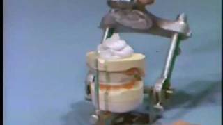 Mounting the Master Casts on the Articulator [upl. by Courtnay]