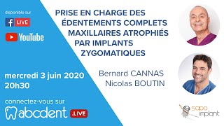 Bernard CANNAS Nicolas BOUTIN  Les implants zygomatiques [upl. by Ahsekam]