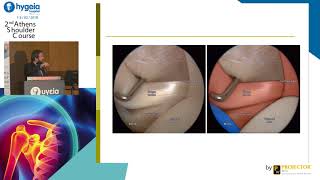 George Skarpas  Arthroscopic anatomy of the shoulder [upl. by Finn]