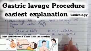 Gastric lavage Procedure stomach wash General toxicology fmt toxicology [upl. by Seve]