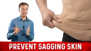 How To Prevent Sagging Skin with Losing Weight – DrBerg On Loose Skin After Weight Loss [upl. by Orvas]