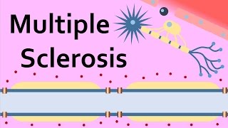 Multiple Sclerosis and the Myelin Sheath [upl. by Feodora]