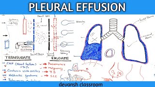 pleural effusion pathophysiology in Hindi part 1 [upl. by Ahsyt70]