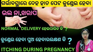 ITCHING during pregnancy itching in pregnancy in odia [upl. by Arok]