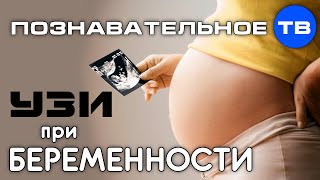 УЗИ при беременности Познавательное ТВ Ирина Волынец [upl. by Anderson]