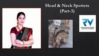 Head amp Neck Spotters Part3 by Dr Rajitha Vanga [upl. by Monjo835]