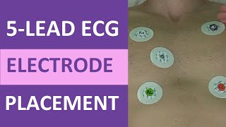 5 Lead ECG Placement of Electrodes EKG NCLEX amp Nursing Mnemonic [upl. by Idnym]