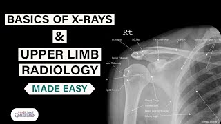 Radiological Anatomy Made Easy Basics of XRays and Upper Limb Radiology [upl. by Dnomde817]