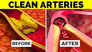 Debunking the Myth Vegetables That Clean Arteries and How to Actually Improve Heart Health [upl. by Emmuela141]