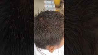 10 Causes of ITCHY Scalp [upl. by Ennaed]