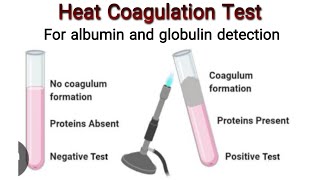 Heat Coagulation Test for identification of Albumin and Globulin  Knowledge Academy [upl. by Aleel160]