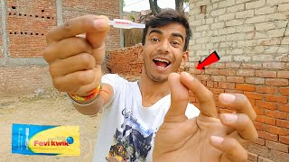 Fevikwik से Finger चिपक जाने पर क्या करें  😬  Fevikwik अपने हाथों से कैसे छुड़ाएं 🤔 [upl. by Azile892]