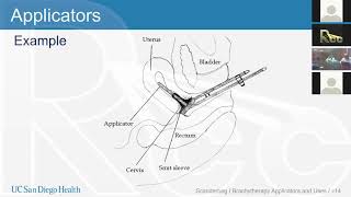 Rayos Contra Cancer HDR Brachytherapy Session 13 Tandem and Ring  Dan Scanderbeg [upl. by Nuhs]