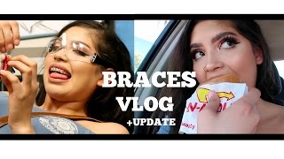 HOW TO EAT IN N OUT WITH BRACES  GETTING MY BRACES TIGHTENED [upl. by Cyrilla121]