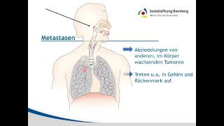 Kurz erklärt Metastasen [upl. by Trimmer]