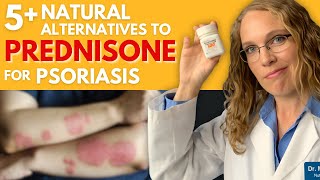 5 Natural Alternatives to Prednisone for Psoriasis [upl. by Annayd]