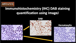 Immunohistochemistry IHC DAB staining quantification using ImageJ [upl. by Garate66]