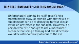 Does Tanning Make Stretch Marks Go Away [upl. by Nerti]