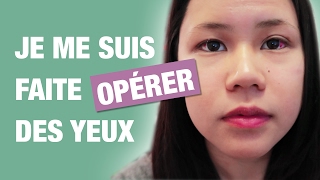 JE ME SUIS FAITE OPERER DES YEUX  Claire Phan [upl. by Arytahs]