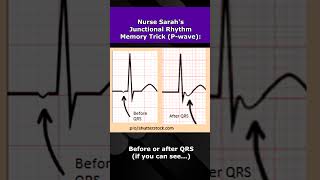 Junctional Rhythms ECG Nursing Mnemonic NCLEX EKG Review [upl. by Yasibit]