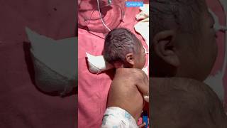 Long Time At Birth Cannel newbornbaby viralvideo [upl. by Gitel557]