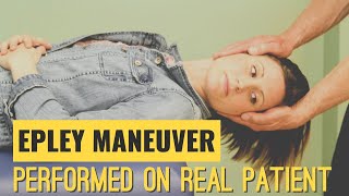 Epley Maneuver Performed on a Real Patient suffering from Vertigo [upl. by Drais]