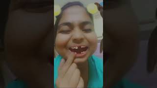 দাঁত না থাকার সুবিধা🤭🤭🤭 funny comedy bongos shortsvideo tiktok viralvideo reel trending fun [upl. by Byran443]