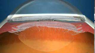 How Fluid Circulates in the Eye [upl. by Kliber]