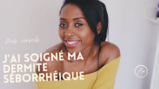 Comment jai soigné ma dermite séborrhéique [upl. by Heim]