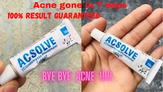 Remove Acne and acne marks in one day  100 percent honest and guaranteed Acsolve gel [upl. by Matrona]