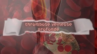 La thrombose veineuse profonde [upl. by Nalid549]