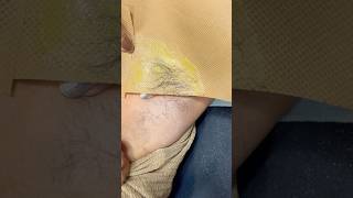 hair  underarms hair remove for wax tutorial  shortvideo [upl. by Tedman455]