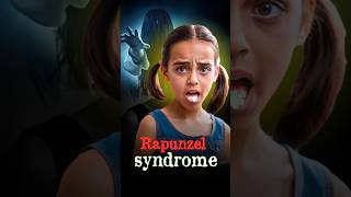 What is Rapunzel Syndrome and How Does It Happen shorts shortsfeed RapunzelSyndrome [upl. by Ahsino]