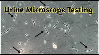 urine sediment microscopy  urine microscopy procedure [upl. by Elenaj]