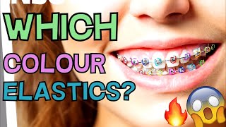 Which Braces Color ELASTICS Should You Get A Simulation To Show Each Colour [upl. by Repinuj887]