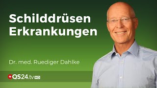 Wenn die Schilddrüse aus der Reihe tanzt  Dr med Ruediger Dahlke  QS24 Gesundheitsfernsehen [upl. by Innavoeg]