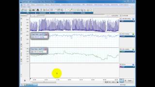 Calculating systolic diastolic and MAP from blood pressure traces [upl. by Adnak]