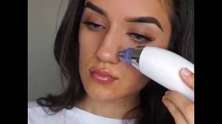 Krasr Comedo Suction Blackhead Remover Review Tutorial and Result By Marjan Tabibzada [upl. by Atram]