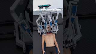 world first head transplant surgery machine shorts short youtubeshorts [upl. by Godfree]