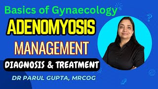 Management of Adenomyosis  Investigations amp Treatment  Part2 [upl. by Wood272]