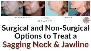 How to Treat Sagging Neck Chin and Jawline  Surgical to NonSurgical Options [upl. by Hi867]