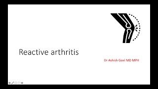 Reactive Arthritis or Reiters Syndrome [upl. by Amelia]