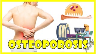 Osteoporosis  Causes Pathogenesis Signs amp Symptoms And Diagnosis [upl. by Thant306]