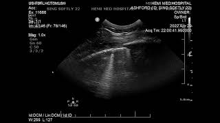 Échographie d’un poulain présentant des fractures de côtes adjacentes au cœur [upl. by Nattirb980]